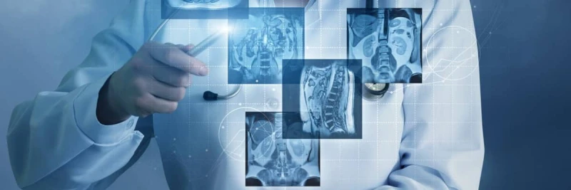 MD in Radiology